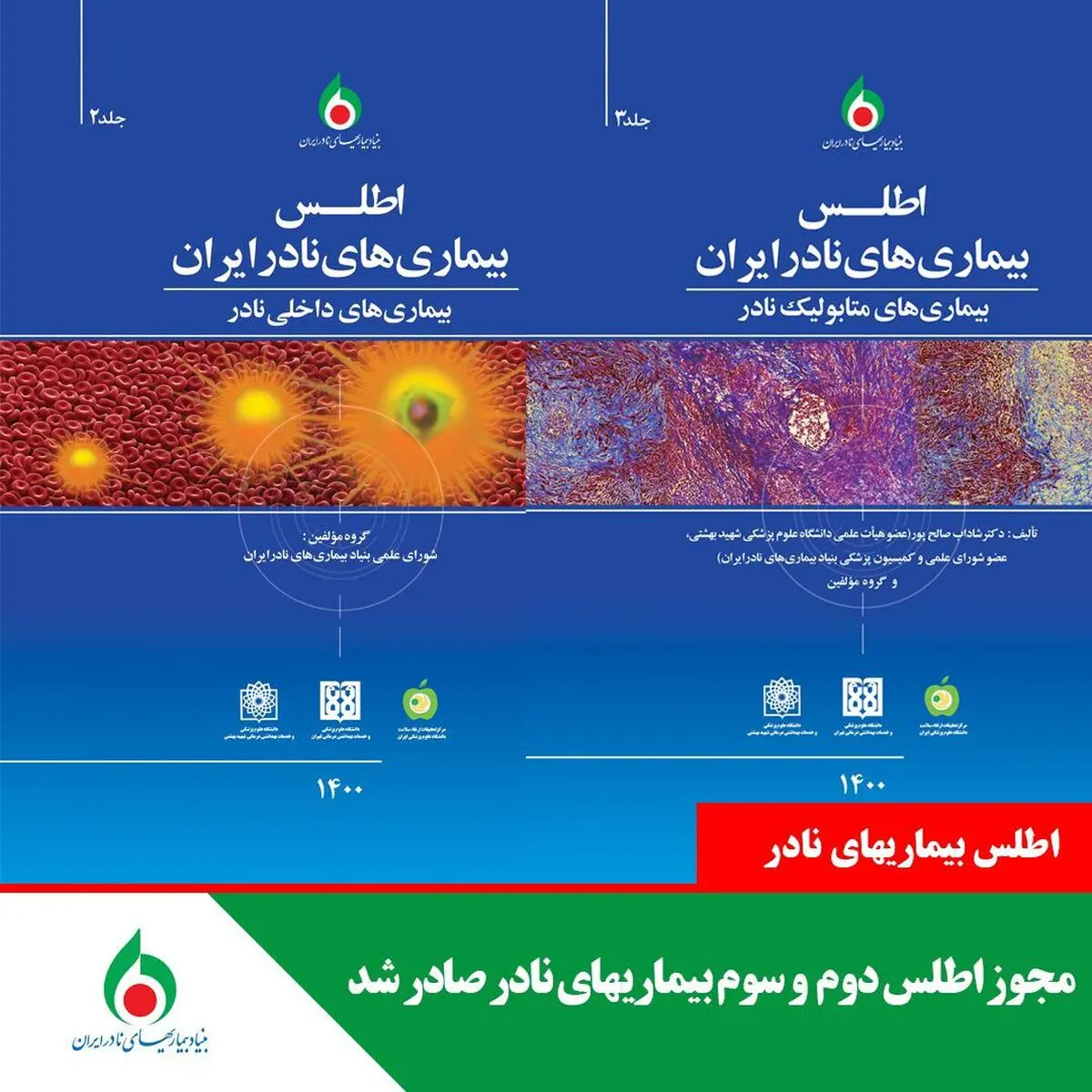 صدور مجوز اطلس دوم و سوم بیماری‌های نادر/ وجود سه میلیون بیمار نادر در کشور