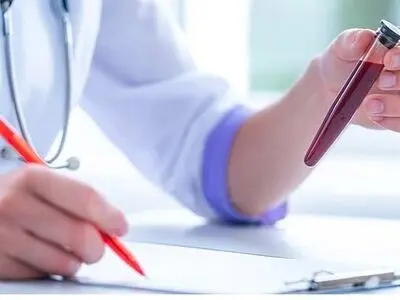 آزمایش در منزل با لیما طب تحت پوشش تمام بیمه ها