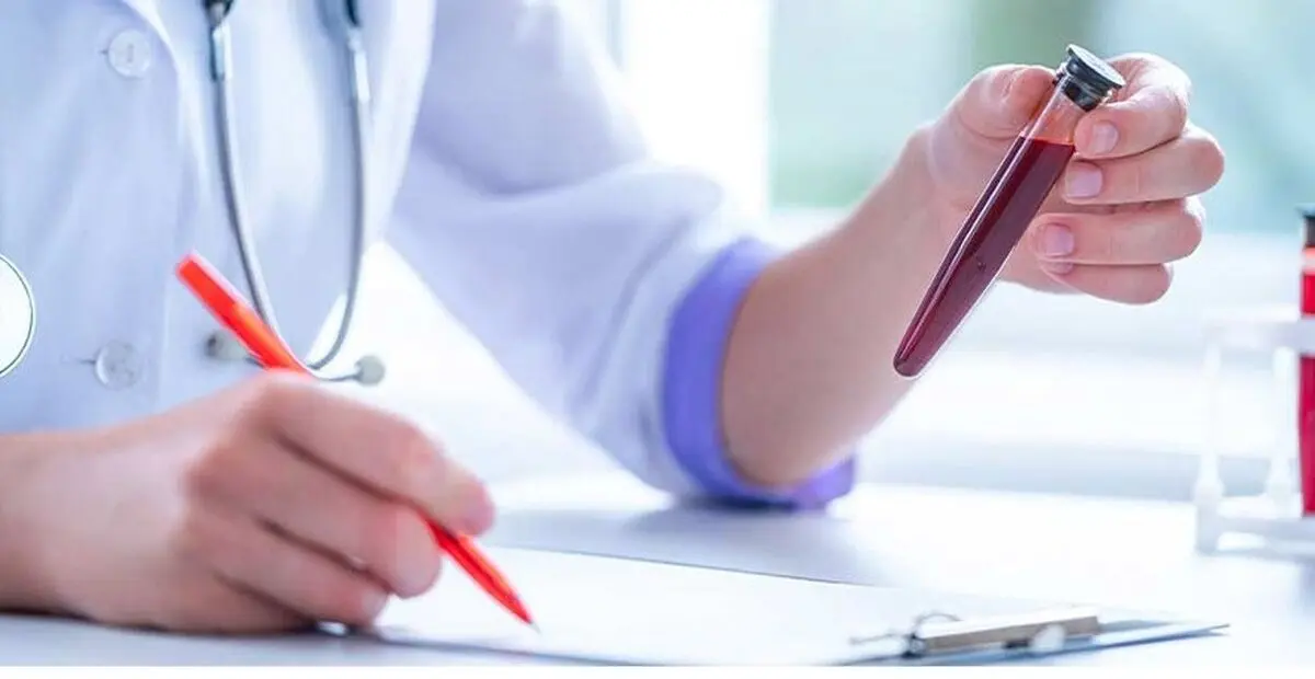 آزمایش در منزل با لیما طب تحت پوشش تمام بیمه ها