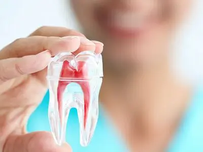 لمینیت یا کامپوزیت، دندان پزشک زیبایی کدام را پیشنهاد میکند؟