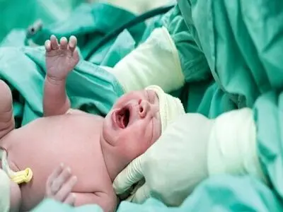 کاهش 7 درصدی آمار سزارین در کرمانشاه