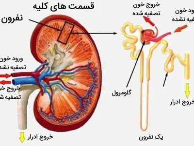 درمان خانگی دفع پروتئین کلیه
