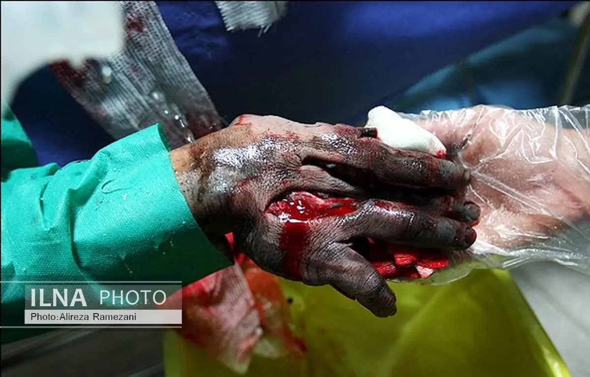 252 مصدوم ناشی از حوادث چهارشنبه سوری