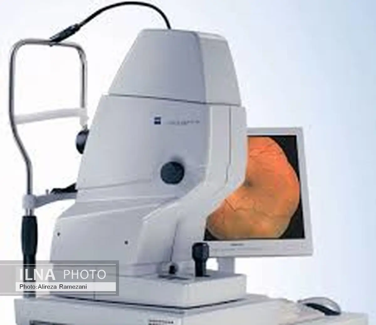 دستگاه فوق پیشرفته چشم پزشکی در شیراز