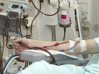 نظارت کامل و بی‌مماشات سازمان غذا و دارو بر تولید محلول‌های دیالیزی