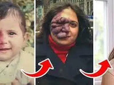 ماجرای زن ایرانی که مردم از خال روی صورتش می ترسیدند+ عکس