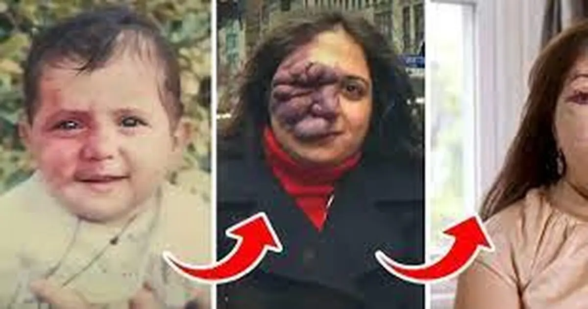 ماجرای زن ایرانی که مردم از خال روی صورتش می ترسیدند+ عکس