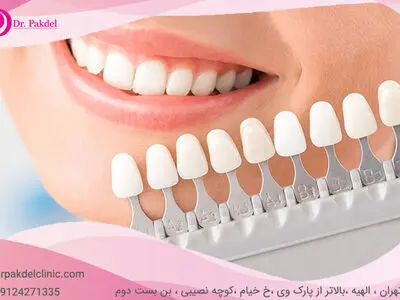 کامپوزیت دندان چیست؟ تفاوت کامپوزیت و لامینیت