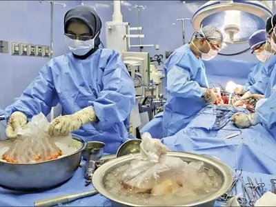 سی و یکمین اهدای عضو در یزد