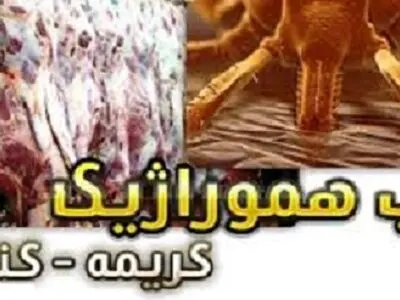 تب کریمه کنگو؛ بیماری بومی تازه شناخته شد