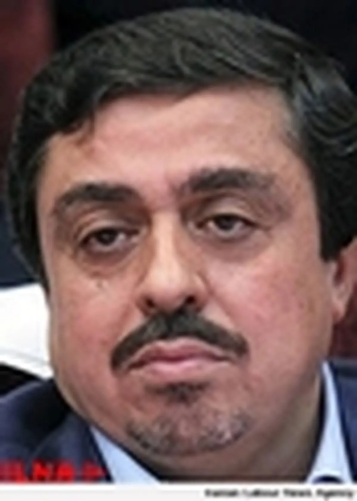 ایجاد هر تخت دیالیز ۲۷۰ میلیون تومان هزینه دارد