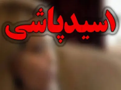 صدور حکم قضایی سارق اسیدپاش با تحمل ۳۰ سال حبس