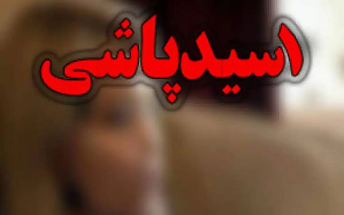 صدور حکم قضایی سارق اسیدپاش با تحمل ۳۰ سال حبس