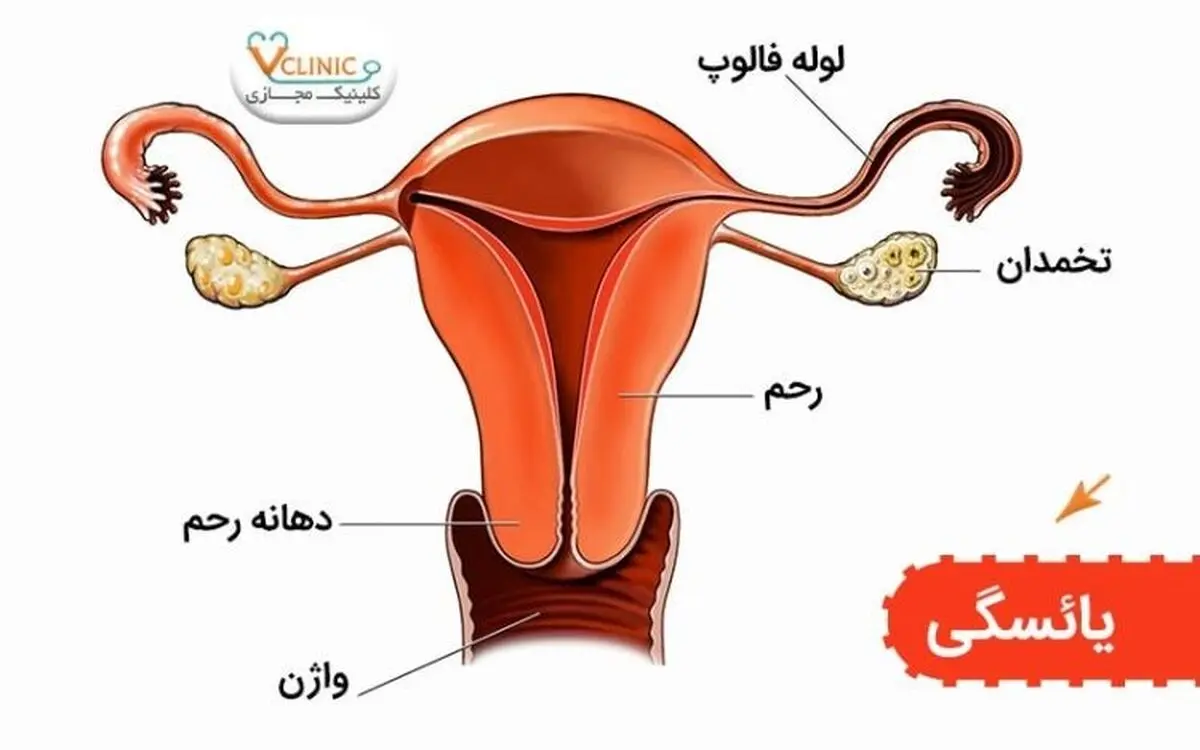 یائسگی چیست؟ و چه زمانی اتفاق می‌افتد؟