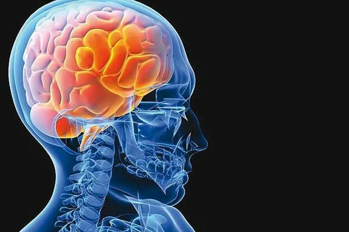 راه‌های جلوگیری از سکته مغزی