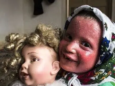 افتتاح بنیاد درمانی بیماری‌های "نادر" کشور در کرمانشاه 