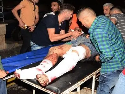 حمله شیمیایی تروریست‌ها به غرب حلب