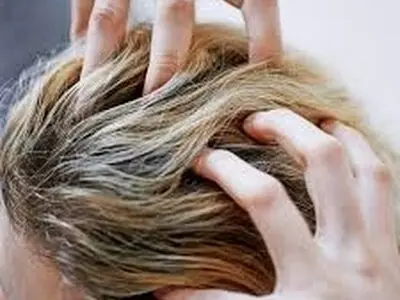 کاشت مو به روش SUT در کلینیک کاشت مو و زیبایی رویان سلامت
