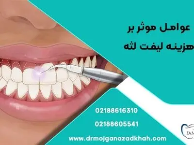 عوامل موثر بر هزینه لیفت لثه