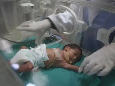 جان باختن نوزاد شیرخواره فلسطینی در اثر محاصره غزه