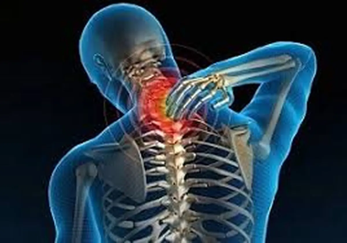 10 درصد جمعیت بالغ کشور مبتلا به استئوآرتریت