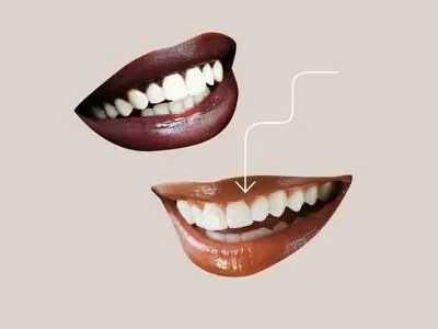 سونامی کامپوزیت‌های ارزان‌قیمت؛ چرا باید به این ارزانی عجیب شک کرد؟