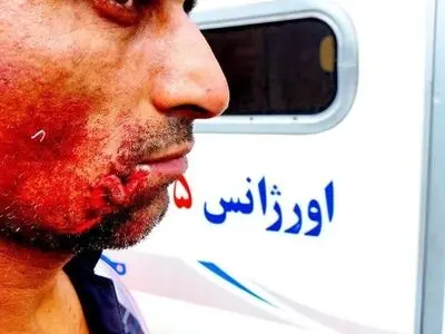 مجروح شدن کارگر شهرداری فردیس بر اثرحمله سگ 