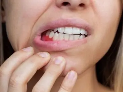 برای تقویت لثه چه بخوریم؟