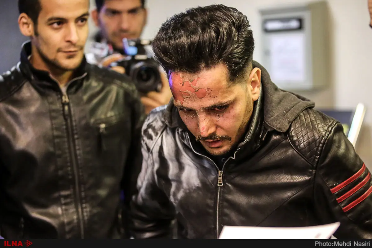 تعداد مصدومان چهارشنبه آخر سال در آذربایجان شرقی به ۱۳۴ نفر رسید/ آسیب چشمی ۷۰ درصد از مصدومان