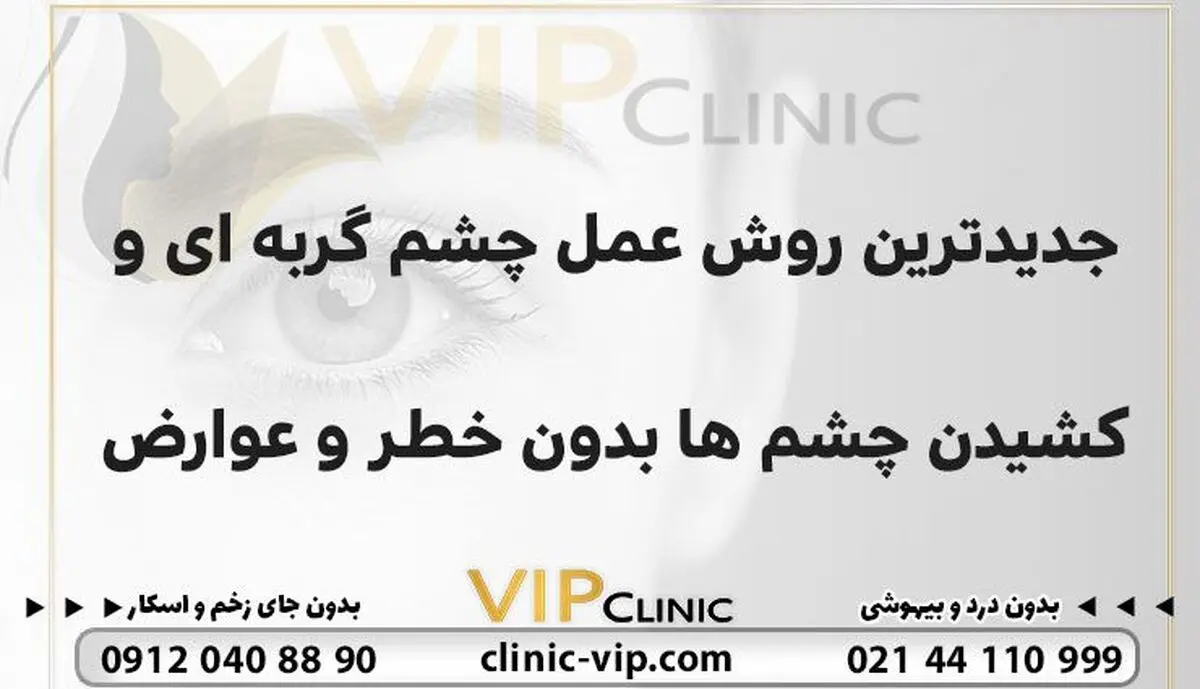 جدیدترین روش عمل چشم گربه‌‍ای و کشیدن چشم‌ها بدون خطر و عوارض
