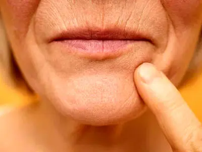 چرا لب‌ها با افزایش سن نازک‌تر به نظر می‌رسند؟