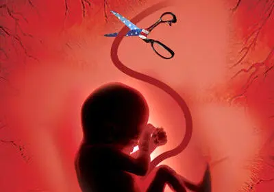 شناسایی و انهدام شبکه سازمان‌یافته فعال سقط جنین غیرقانونی در سمنان