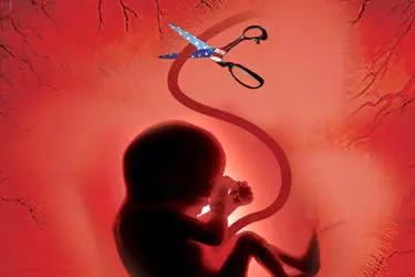 شناسایی و انهدام شبکه سازمان‌یافته فعال سقط جنین غیرقانونی در سمنان