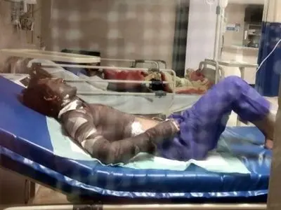آخرین وضعیت دو کارگر مصدوم حادثه پمپ بنزین زابل/ یکی از کارگران با سوختگی بالا به مشهد منتقل شد
