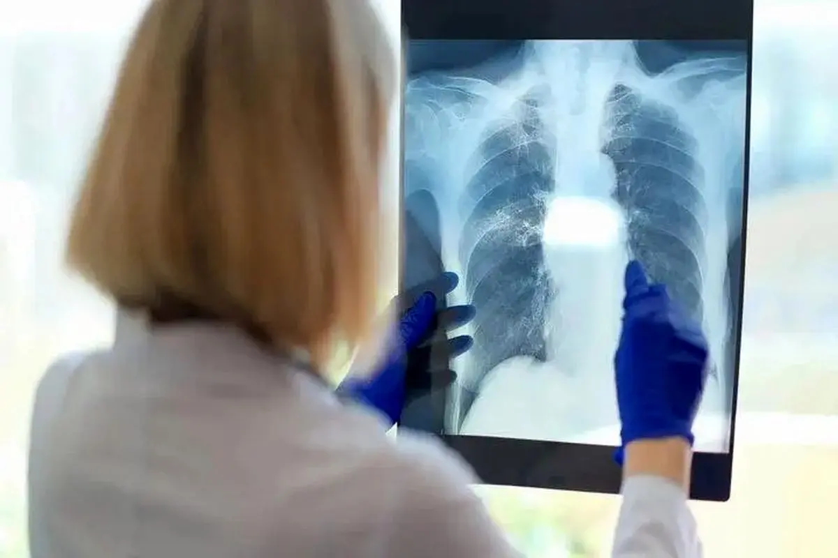 یک مشکل پنهان تنفسی ممکن است دلیل خستگی مزمن باشد 