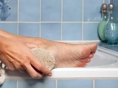 درمان میخچه پا در منزل