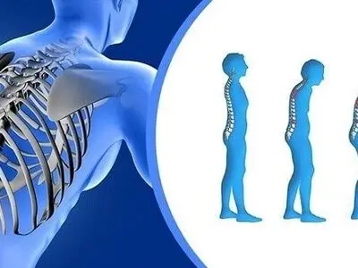 ادغام برنامه ملی کنترل پوکی استخوان در نظام مراقبت‌های اولیه سلامت