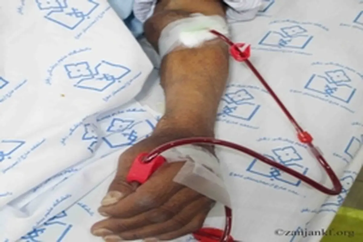 بخش پیوند کلیه زنجان هر چه سریع‌تر راه‌اندازی شود