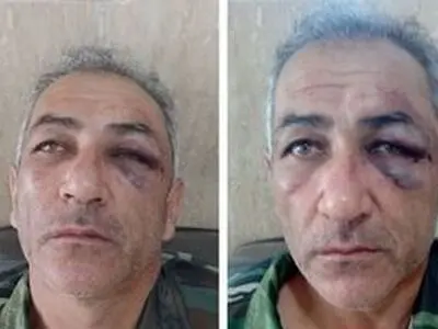 ضرب و شتم جنگلبان در آستارا / ۲ نفر از قاچاقچیان دستگیر شدند