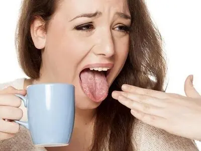 چند راهکار طبیعی برای تسکین سوختگی زبان