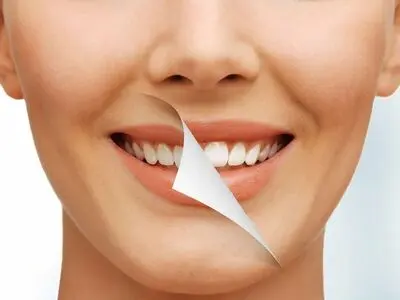 ارتودنسی فوری چیست و برای چه کسانی مناسب است؟