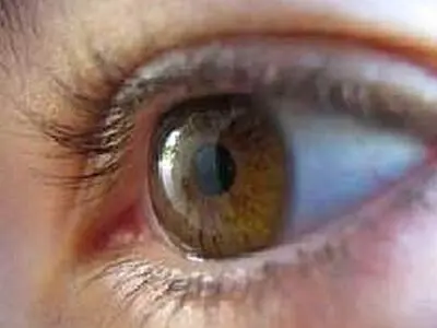 گذشت از قصاص چشم در نوروز 