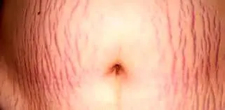 asdasd