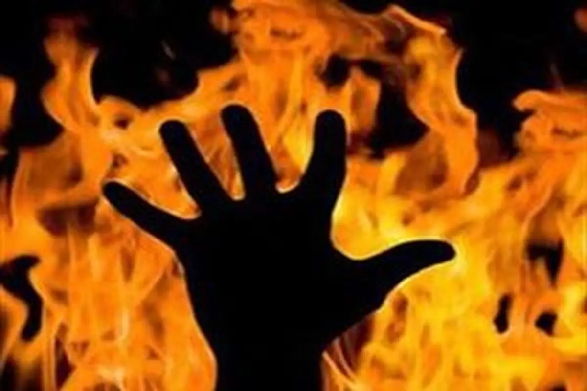 پدری، پسرش را به آتش کشید+ عکس  