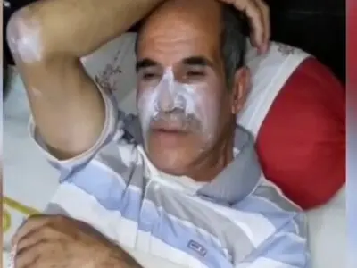 اولین مصدوم آتش‌سوزی جنگل های گچساران روانه بیمارستان شد