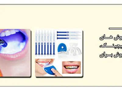 تکنولوژی های جدید در ایمپلنت، ایمپلنت لیزری با تحویل یک روزه