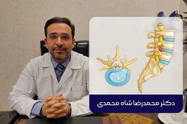 بهترین روش درمان دیسک کمر از نظر متخصص عمل جراحی دیسک کمر در تهران