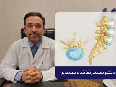 بهترین روش درمان دیسک کمر از نظر متخصص عمل جراحی دیسک کمر در تهران