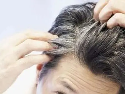 این مواد غذایی رشد موی‌تان را زیاد می‌کند