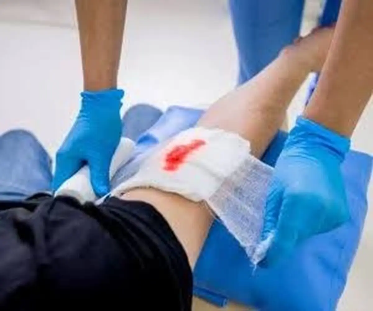 کارشناس اورژانس: اگر باند برای بستن محل خونریزی نداشتید می‌توانید این کار را انجام دهید+ فیلم
